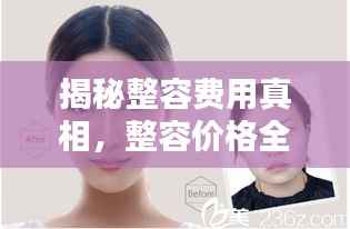揭秘整容费用真相,整容价格全面解析,费用构成一览无余!