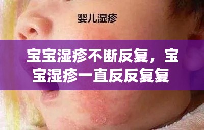 宝宝湿疹不断反复,宝宝湿疹一直反反复复