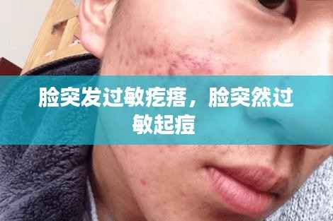 脸突发过敏疙瘩,脸突然过敏起痘