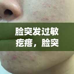 脸突发过敏疙瘩,脸突然过敏起痘